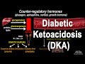 Diabetic Ketoacidosis (DKA) Pathophysiology, Animation