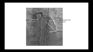 Coronary angiographic views- Elias Hanna