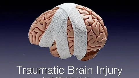 TBI lecture