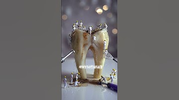 Keeping the Tooth Clean #ai