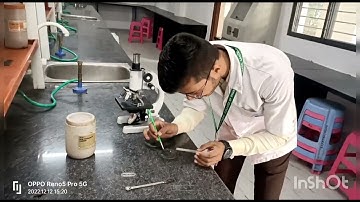 Pharmacognosy 2 Experiment TS Of Cinchona Bark