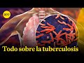 Tuberculosis: ¿Cuál es la diferencia entre ser portador y estar enfermo?