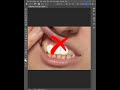 How To Whiten Teeth #PhotoshopTutorial #smartgraphics Mp3 Song