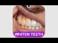 How To Whiten Teeth #PhotoshopTutorial #smartgraphics