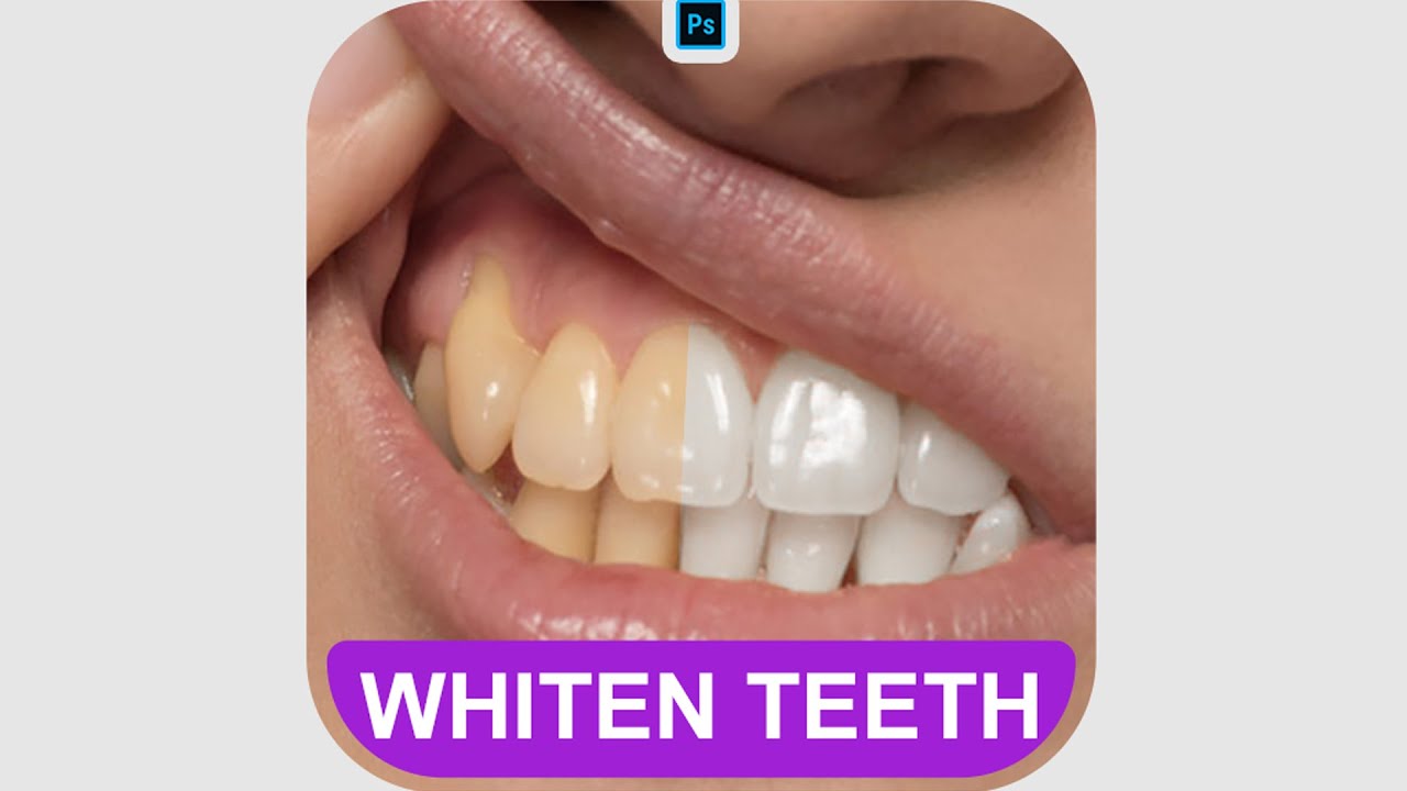 How To Whiten Teeth #PhotoshopTutorial #smartgraphics