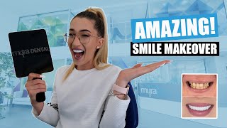 Smile Makeover Review [All on 6 Dental Implants | Veneers Turkey]