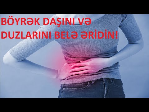 Video: Yüngül Görüntü Solğunlaşdı