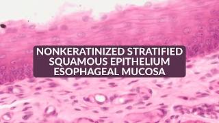 Non-keratinized Stratified Squamous Epithelium | Esophageal Mucosa