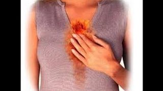 E gástrico fibromialgia refluxo