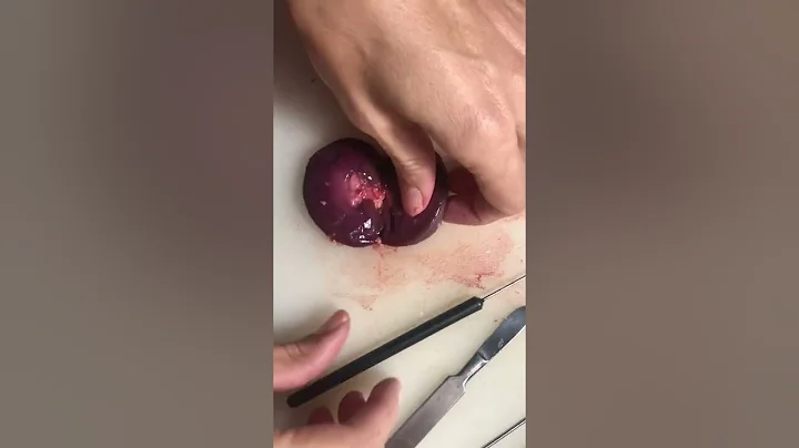 21209679 Elizabeth Vermeulen- kidney dissection- T...