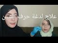 لدغة حرف الشين علاج نطق حرف الشين عند الأطفال أ هبة السقا أخصائية نطق وصعوبات تعلم تربية خاصة 