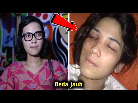 Dulu Dipuja Puji Setinggi Langit, Lihat Sendiri Nasib 7 Artis ini Sekarang