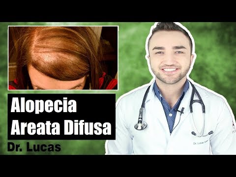 Vídeo: O que causa a alopecia difusa?