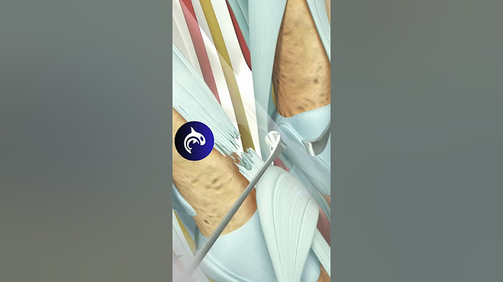 See how an Extensor Tendon Injury of the Hand is Repaired - 3D Animation