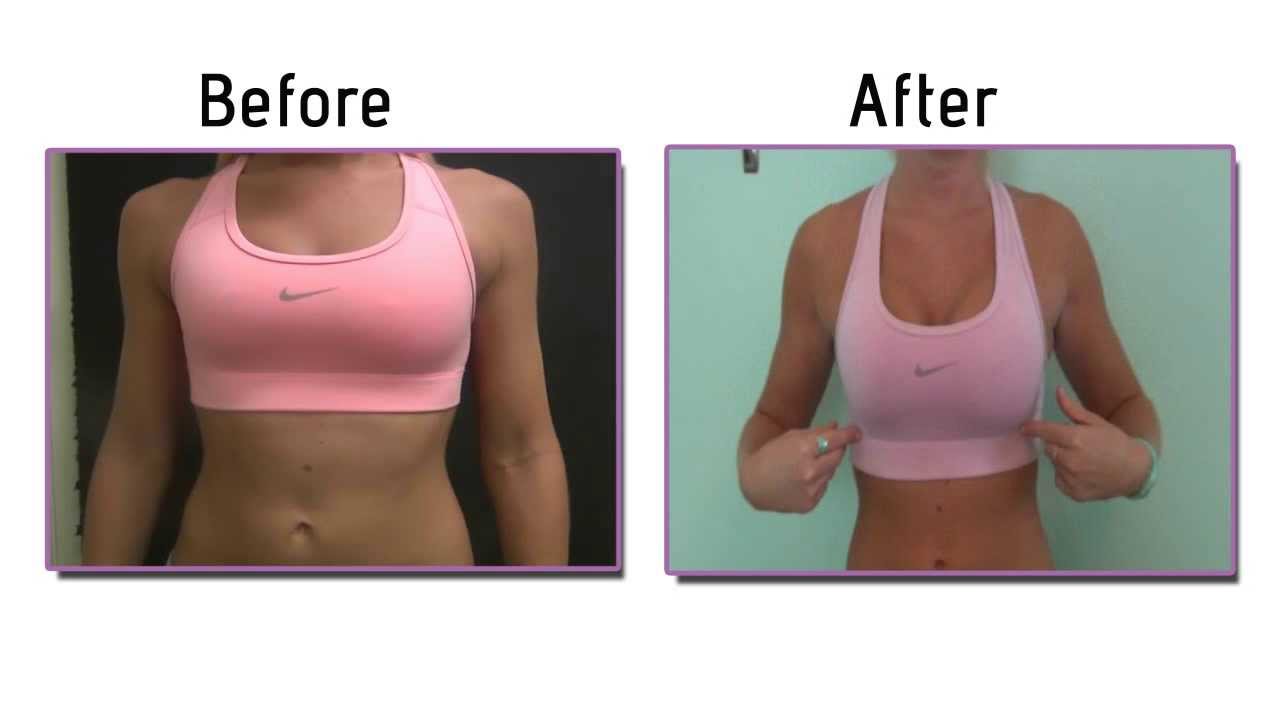 one breast breast painful aumentation