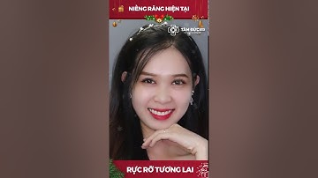 😍NIỀNG RĂNG BÂY GIỜ, RỰC RỠ TƯƠNG LAI😍