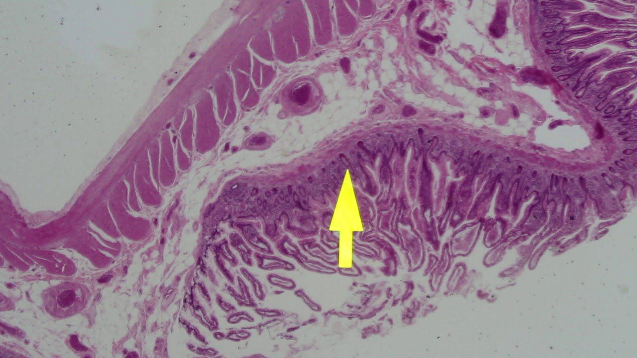 Digestive tract part 6 - YouTube