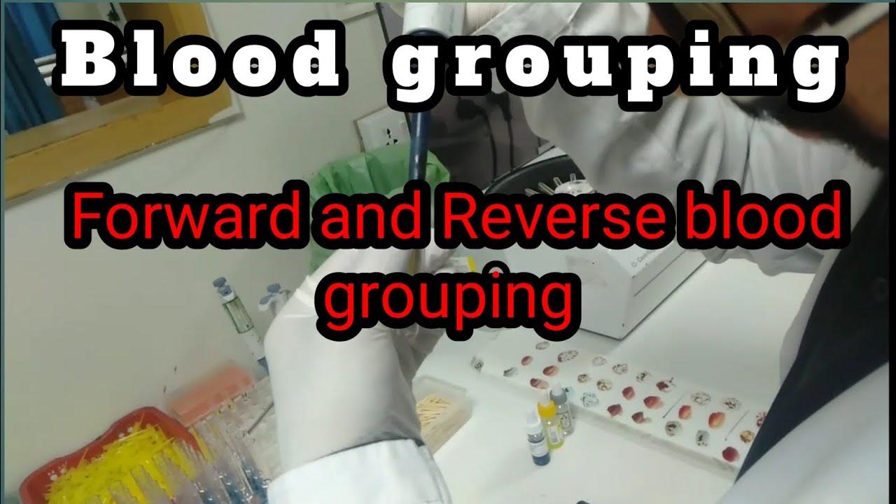 Procedure of Blood grouping (Forward and Reverse blood grouping) YouTube
