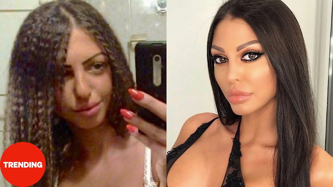 Zadrugarke pre i posle PLASTIČNIH OPERACIJA