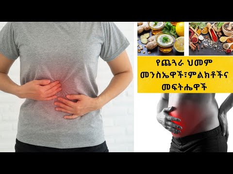 ቪዲዮ: የፔፕቲክ ቁስለትን እንዴት መከላከል ይቻላል?