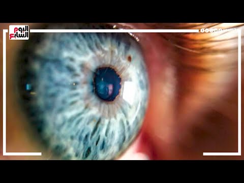 اختراق طبي إنتاج أنسجة العين باستخدام الطباعة ثلاثية الأبعاد والخلايا الجذعية