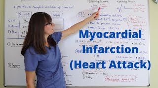 Myocardial Infarction (Heart Attack)