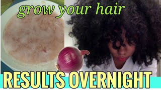 Your hair will grow like  crazy if you use this everyday | Grow long hair fast #preciousteal