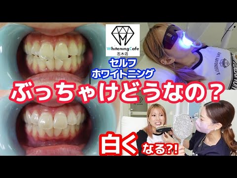 日本未発売】 セルフホワイトニング プラチナムGE40g 10本 その他