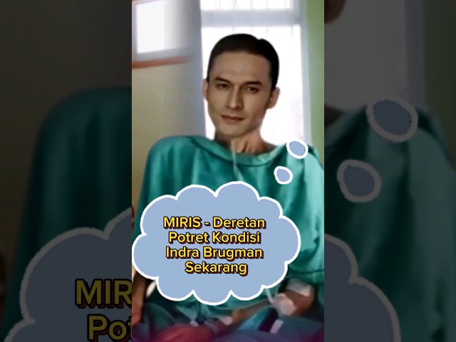 MIRIS - Deretan Potret Kondisi Indra Brugman Sekarang class=