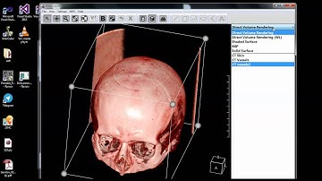 Export from DICOM to PLY file format
