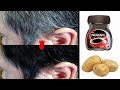 White hair to black hair naturally in just 3 minutes and grow long hair fast