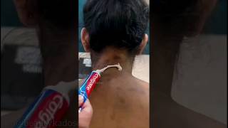 काली Neck & Elbow को गोरा कैसे करें ?🤯❌🤦‍♀️| Neck Back & Body Tan Dark Spots Removing Remedy #shorts screenshot 3