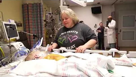 Conjoined identical twin girls successfully separa...