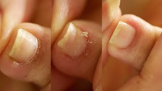 AT HOME PEDICURE | Detailed Cuticle Work