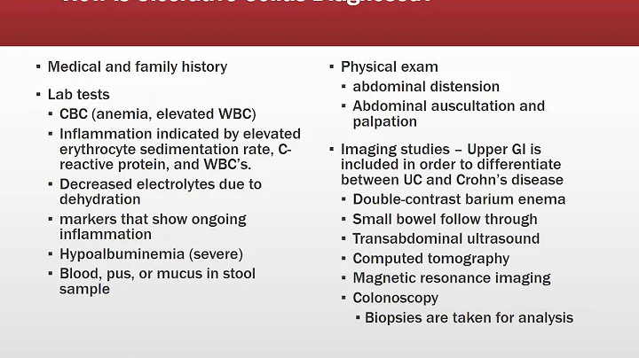 Ulcerative Colitis