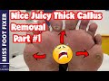 Part #1 : Nice Thick Juicy Callus Removal Full Treatment By Miss Foot Fixer