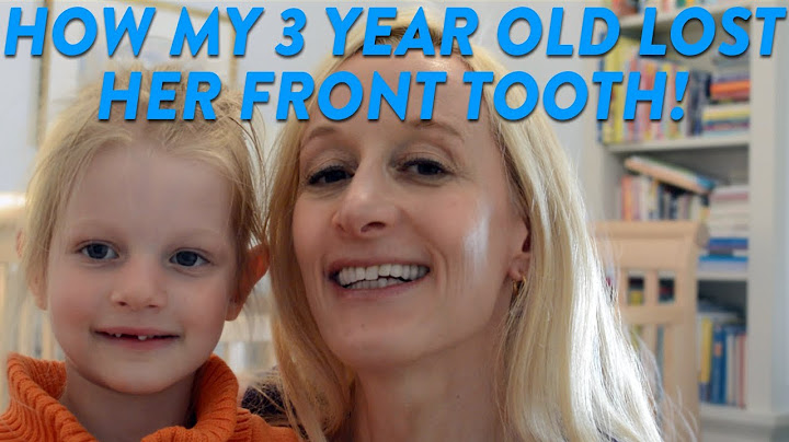 How My 3 Year Old Lost Her Front Tooth! | CloudMom
