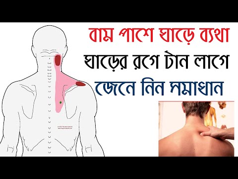 ভিডিও: কিভাবে ডিপ ভেইন থ্রম্বোসিস (DVT) এড়ানো যায়: 11 টি ধাপ