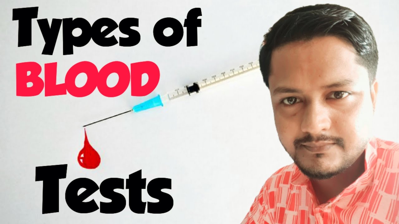 What Is Blood Tests Types Of Blood Test Importance OF Blood Test what-is-blood-tests-types-of-blood-test-importance-of-blood-test