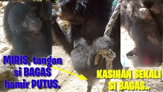 Miris TANGAN Bagas HAMPIR putus