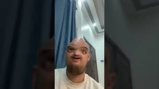 Ekseri 😂 😭 💊