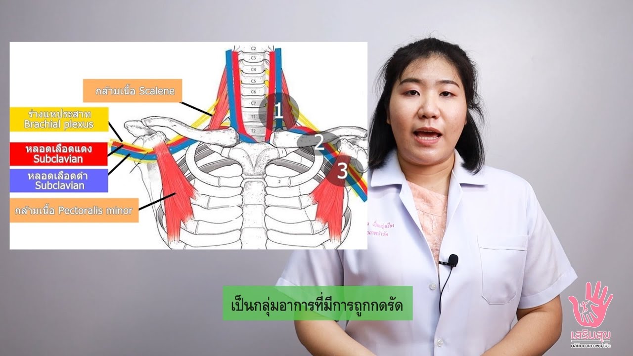 งาน outlet คือ  Update New  กลุ่มอาการ TOS  หรือ Thoracic outlet syndrome