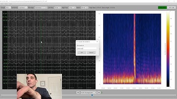My First Version of Quantitative EEG (qEEG) 📊