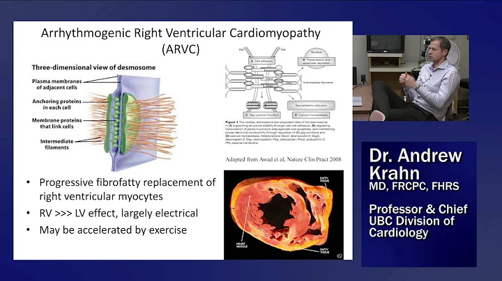 Dr. Andrew Krahn,"Modern Use of the Signal Average...