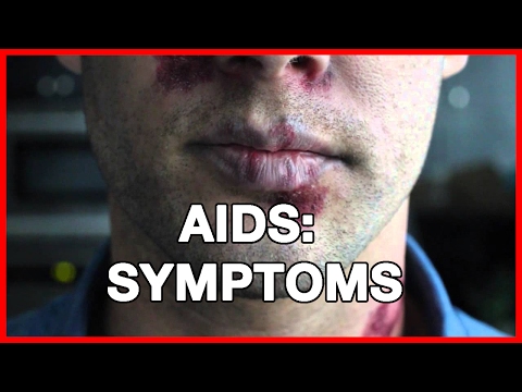 Aids: Symptoms and Treatment of Aids @HealthWebVideos