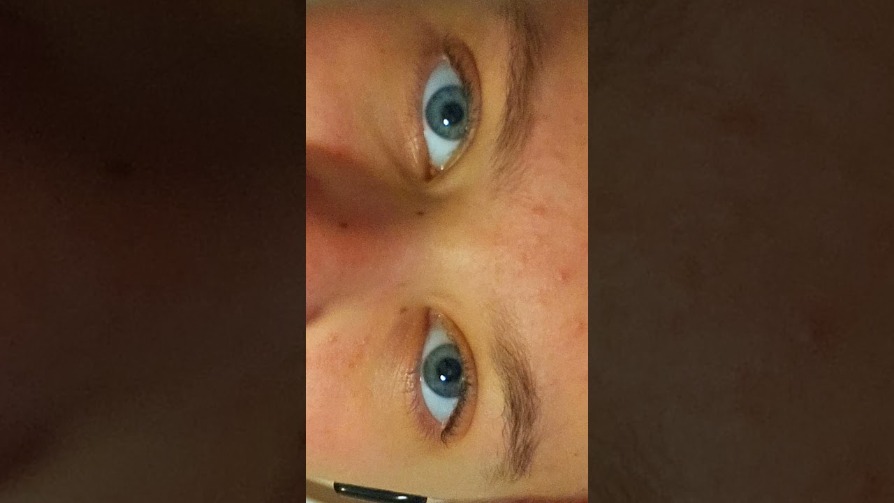 My pupils are different sizes, my right eye is bigger.