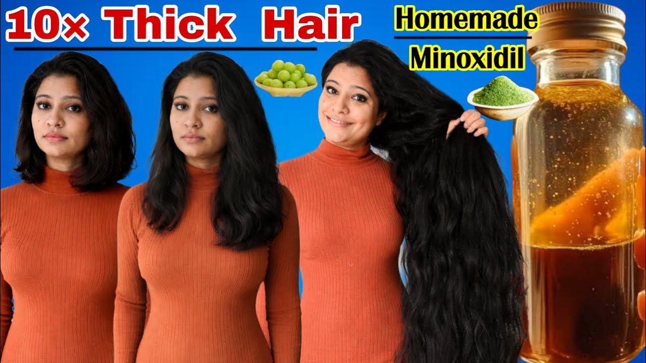 Homemade Minoxidil To Get 10×Thick Hair & To Regrow Hair Fast ।Garima Singh ।