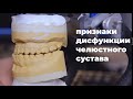 Какие признаки явно дают понять о патологии челюстного сустава?