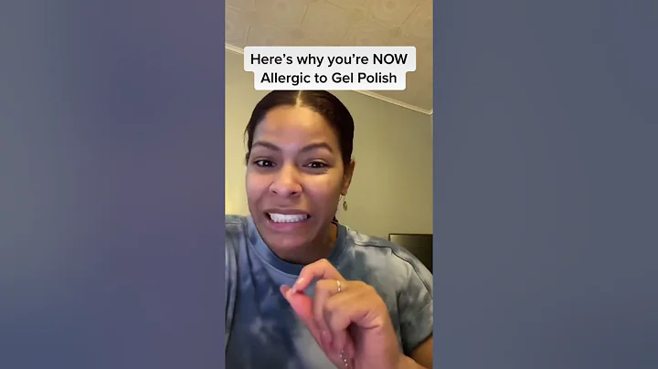 How I Became Allergic to Gel Polish