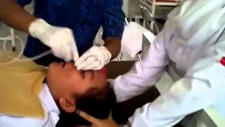 memasangkan NGT STIKES INSAN UNGGUL SURABAYA